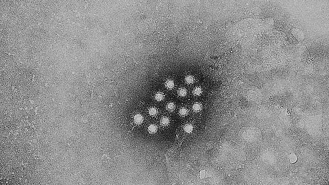 According to the National Centre for Biotechnology Information, the prevalence of Hepatitis A ranged from 2.1 percent to 52.5 percent. (Wikimedia Commons)