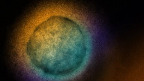 "Nipah is a zoonotic virus (transmission of virus from animal to humans)," said Bahl noting that "fruit bats are the reservoirs" of the virus. (Wikimedia Commons)