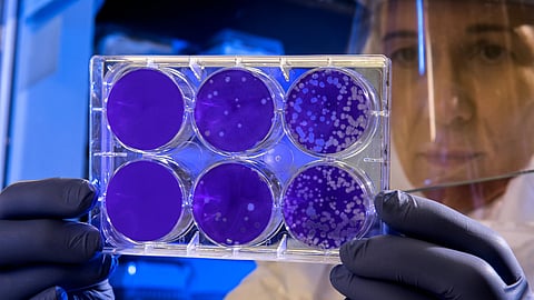 A team of Israeli scientists has created a complete human embryo model using stem cells that closely mimics the real one, but without sperm or egg. (Unsplash)