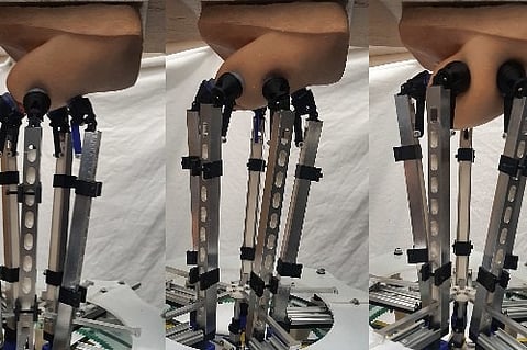 The device, designed by a team at the University of Bristol is able to apply very specific forces over a range similar to forces used by human examiners and can detect lumps using sensor technology at larger depths than before. (Unsplash)