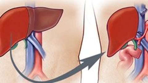 Three persons waitlisted for organs got a new lease of life on Dassehra (October 24) from a 66-year-old male from Mulund, who was declared brain dead a day earlier, officials said here on Wednesday.(IANS)