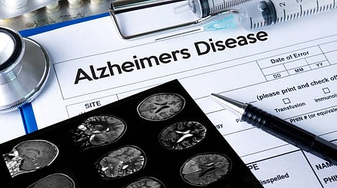 Medical documents labeled ‘Alzheimer’s Disease’ placed beside brain scan images, a pen, and a syringe