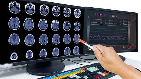 “Person pointing at brain scan images on a screen