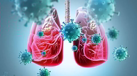 Lungs attacked by virus particles