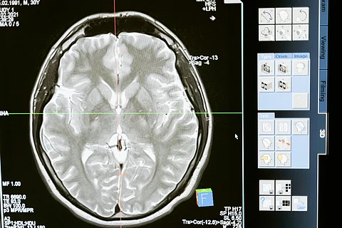 “The Information Content of Brain Wiring,” will be based at Freie Universität’s Institute of Biology