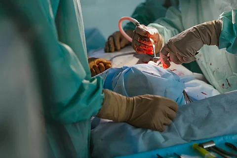 Hysterectomy, the surgical removal of the uterus, fallopian tubes and ovaries, is often wrongly recommended for conditions where less invasive treatments may suffice. Photo: Olga Kononenko/Unsplash
