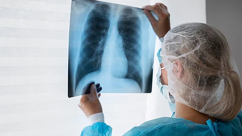 A doctor evaluating X-ray.
