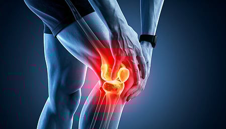 Knee joint pain graphical image