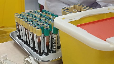 Blood samples in test tubes next a yellow container