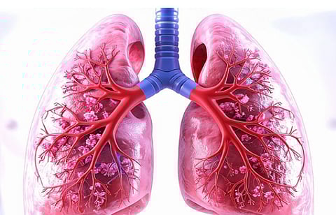 Gujarat meets TB detection target: Over 91 pc recovery rate under national elimination drive (Photo: IANS)