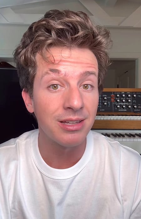 Charlie Puth says he is prone to getting sick over sounds