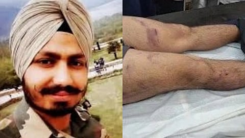 In the image collage of two images is shown on the right side Jaswinder is shown and on the left side his legs completely bruised are shown