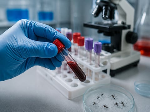representational photo of the Japanese Encephalitis virus