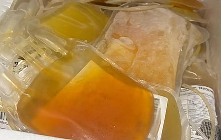 in The Image Adulterated plasma is shown
