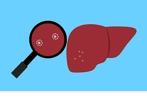 Consults For Liver Diseases Increased Amid Pandemic