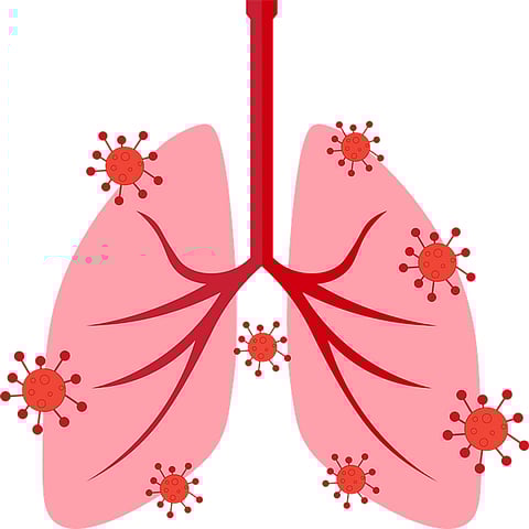 New 3d Model Invented To Test Therapies For Covid