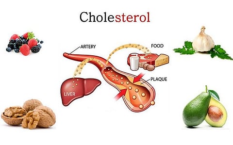 Study: Not All Good Cholesterol Is Healthy