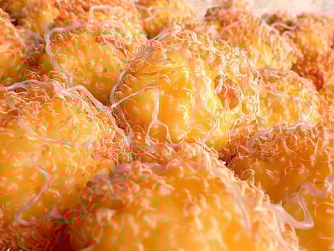 Fat Cells May Influence How Body Reacts To Heart Failure