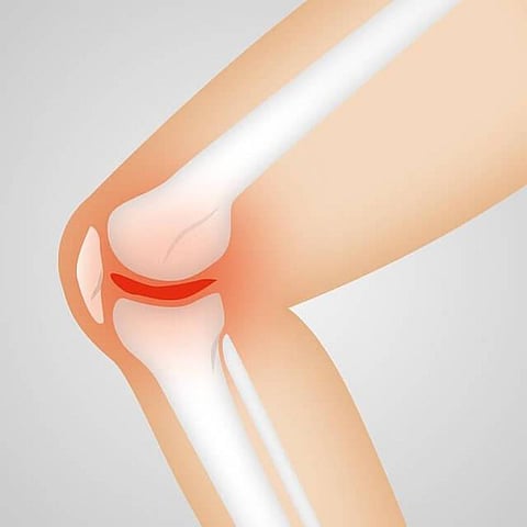 Study: Alternative Surgery Method For Total Knee Replacement