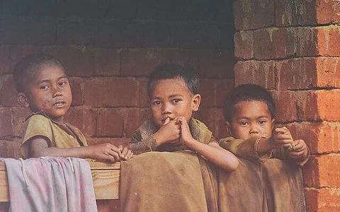 CMAM Association: Rise In Severe Acute Malnutrition In Children A Major Worry