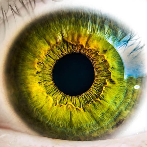 AI Interprets Retinal Images To Identify Alzheimer’s Disease