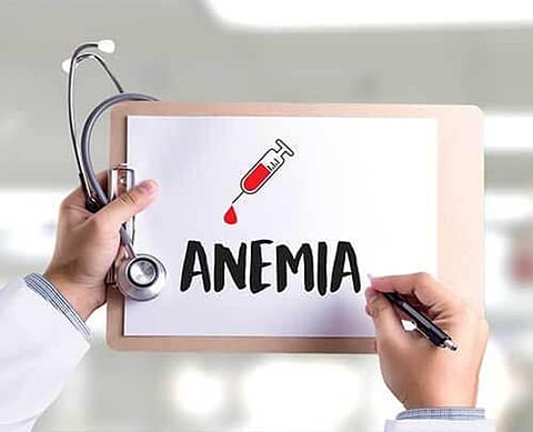 50 Percent Of Anemia Worldwide Is Due To Iron Deficiency: Report