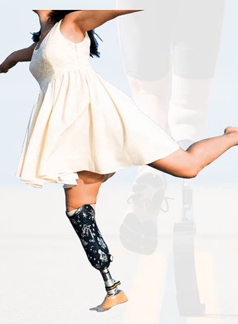 Artificial Limbs to Differently-Abled by Charitable Body