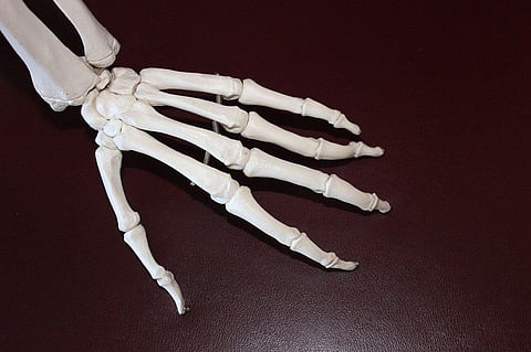 Arthritis Patients in India Suffer Due to Fewer Rheumatologists