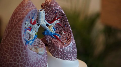 Asthma Patients Not At Risk From Covid-19
