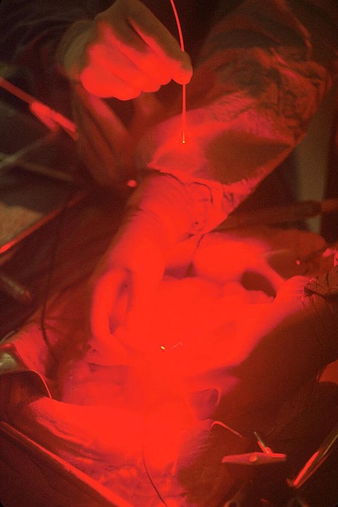 A Therapy to Combat Secondary Infections in Covid-19 Patients