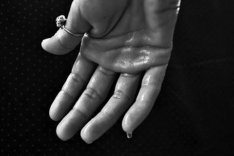 Women Experiencing Hot Flushes, Night Sweats Likely to Get Heart Attacks