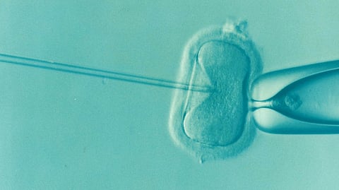 Women Anxious Before IVF May Face Serious Mental Disorders if the Treatment Fails: Report