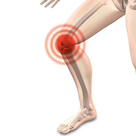 Here’s What You Need To Do When You Have A Locked Knee