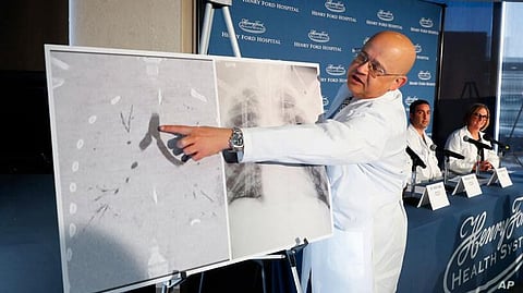 Michigan Teen Gets First Double Lung Transplant Linked to Vaping