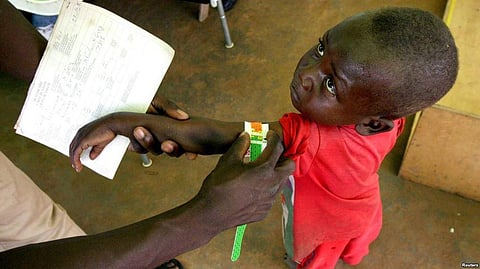 FAO: 822 Million Suffer from Chronic Malnutrition; 2K Million Face Food Insecurity