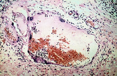 Sikh Man Wears Rainbow Turban for Pride Month