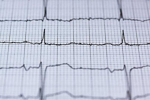 Beware! If You Work In Shifts, You Are At A Greater Risk Of Heart Diseases
