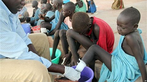 Guinea Worm Diseases Moves Towards Total Eradication