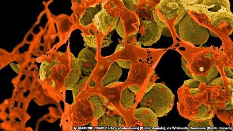 Transgender Persons Bill Faces Objection by LGBTQ Community