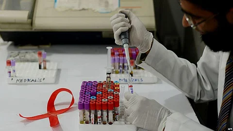 HIV Epidemic Spreading Rapidly In Pakistan: WHO