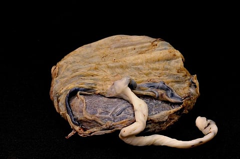 Air Pollution Particles Found In Mother’s Placenta: Study