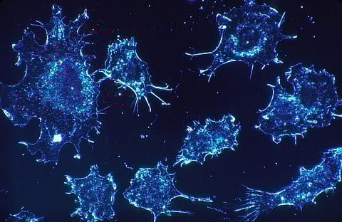 Decoded: How Cancer Cells Cripple Immune System