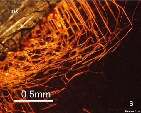 WHO Experts Start Ebola Vaccinations In Congo