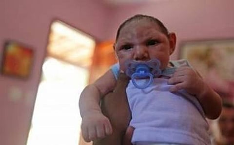 Novel Vaccine Approach Proves Powerful Against Zika Virus