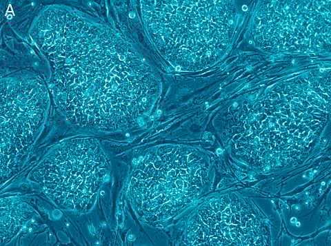 Using stem cells may provide a cure for baldness