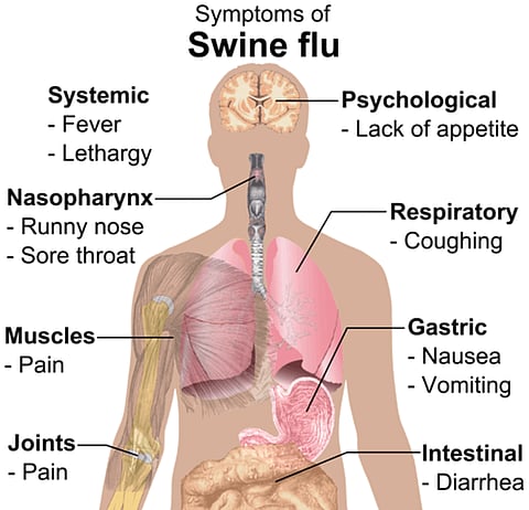Swine Flu Guide: All You Need to Know about the Global Pandemic Disease!