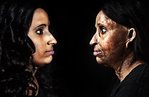 WoWakening: A Campaign to Celebrate Bravery of Acid Attack Survivors