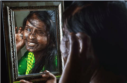 EXCLUSIVE: Can a Scarred Face look Beautiful? Spiritual Healing with Niraj Gera