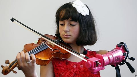 Undergrads at George Mason University in US Build Prosthetic Arm for 10-year-old Violinist Isabella Nicola