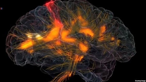 Scientists develop a Drug likely to benefit people with Alzheimer’s Disease